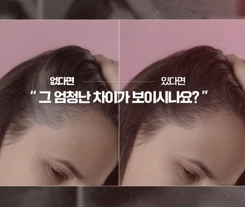 닥터그루트 혈행개선 샴푸 - 니즈